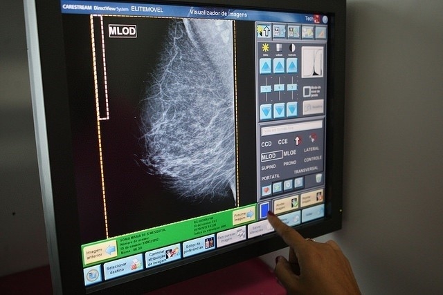 Las unidades móviles de mamografías se desplazarán a Puebla de Sancho Pérez en la comarca durante el mes de abril