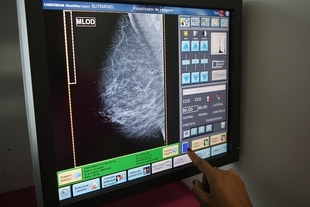 1138 mujeres de Los Santos de Maimona se realizarán mamografía durante 12 días este mes de febrero